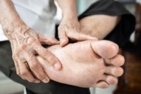 Impact of Rheumatoid Arthritis on Feet