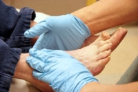 How Does Diabetes Affect the Feet?