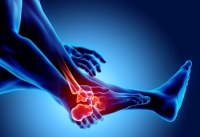 Effective Relief Methods for Arthritic Feet