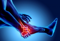 Foot Trauma Can Happen Gradually or Suddenly