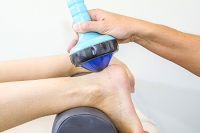 The Power of Extracorporeal Shockwave Therapy for Plantar Fasciitis