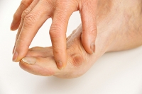 Possible Relief Methods For Bunions